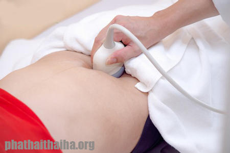 Chữa u xơ tử cung như thế nào cho hiệu quả?